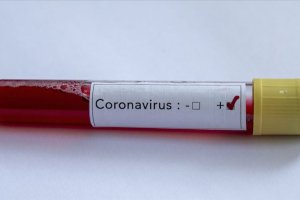 Başbakan Angela Merkel'e sunulan raporda Almanya'da günde 200 bin koronavirüs testi yapılacak
