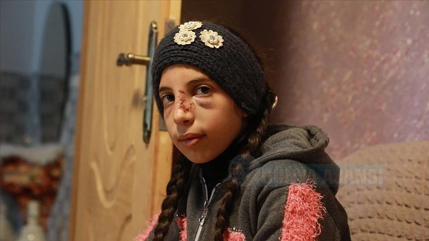 Saldırganlardan zor kurtulan Filistinli küçük kız korku içinde yaşıyor